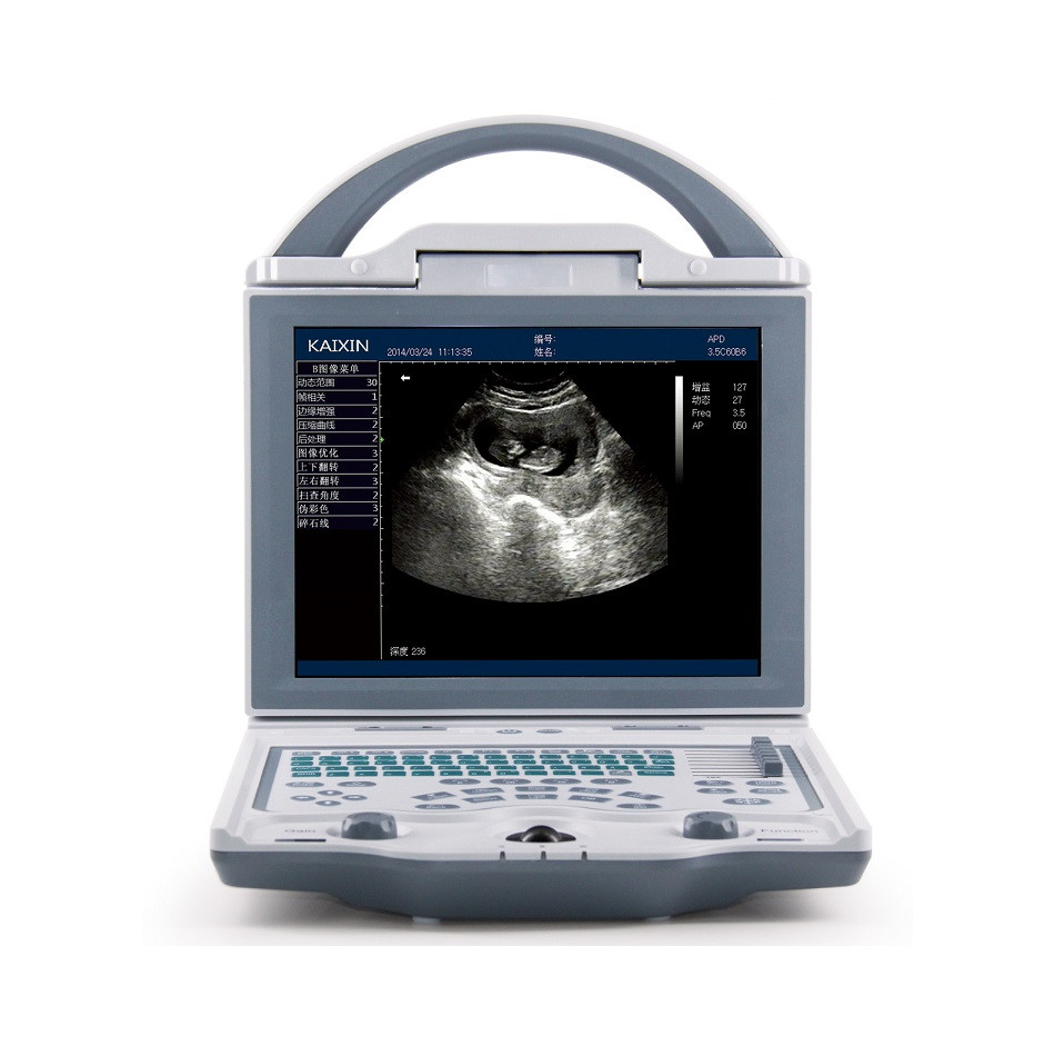 Rechargeable Human Ultrasound Scanner -KX5600